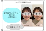 美容鍼受けてみた！体験、感想ガチレビュー！～感想編～
