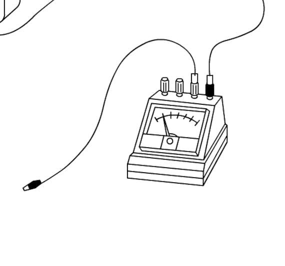 編集部ブログ美容鍼説明②