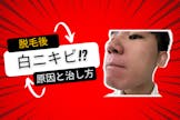 脱毛後に白いニキビが！原因と早く治す方法を調べたのでまとめてみました。